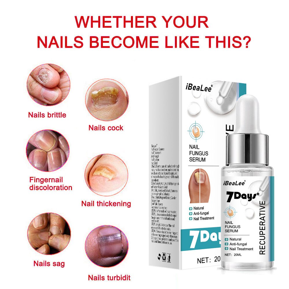 7 DAYS Repair Nail Fungus Treatments Essence Foot Care Serum Toe Nails Fungal Removal Gel Anti-Infection Onychomycosis