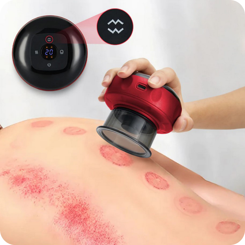 electric cupping massager