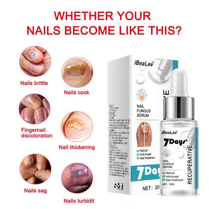 7 DAYS Repair Nail Fungus Treatments Essence Foot Care Serum Toe Nails Fungal Removal Gel Anti-Infection Onychomycosis