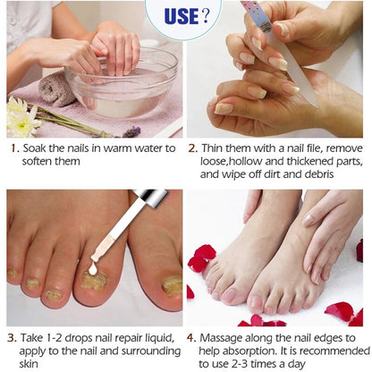 7 DAYS Repair Nail Fungus Treatments Essence Foot Care Serum Toe Nails Fungal Removal Gel Anti-Infection Onychomycosis