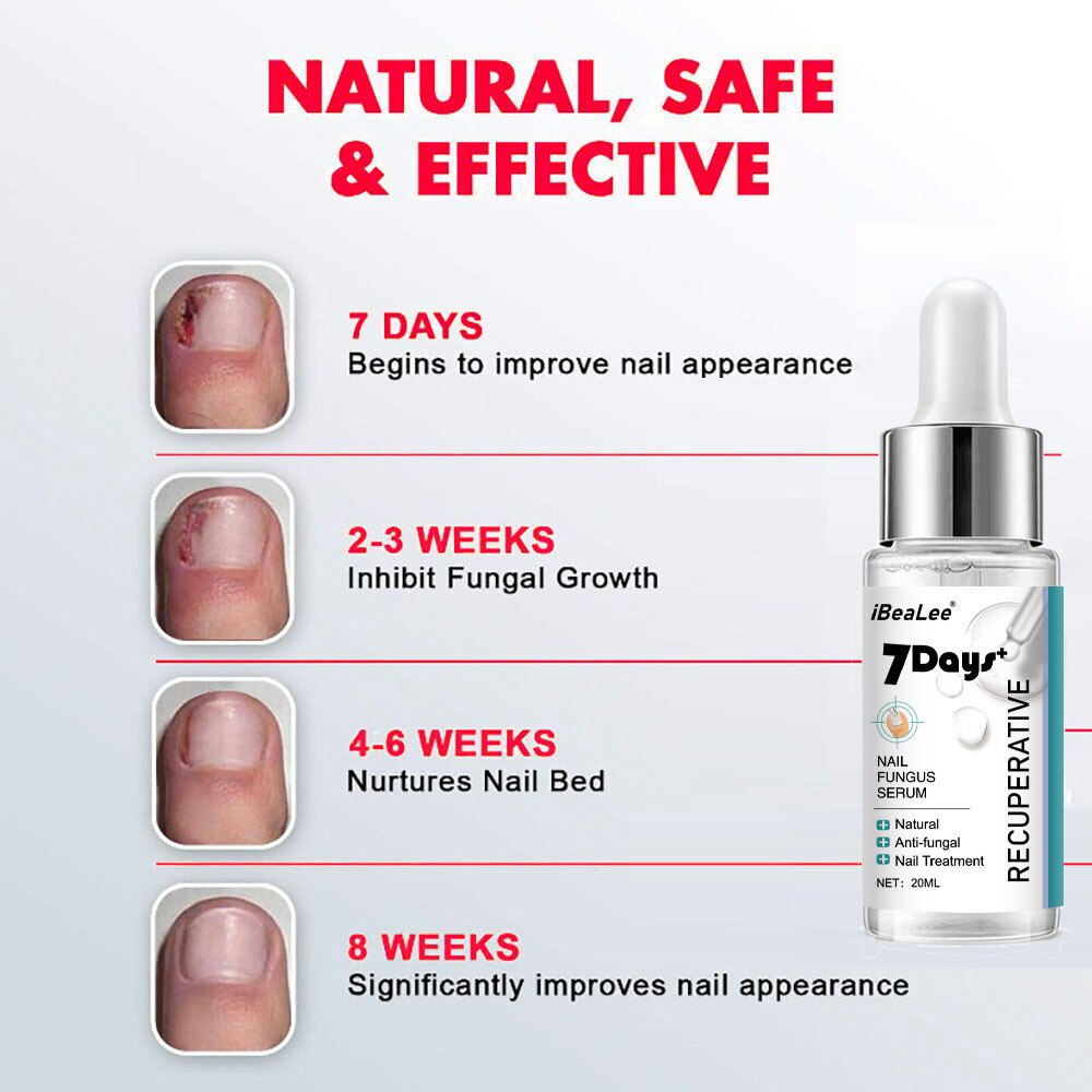 7 DAYS Repair Nail Fungus Treatments Essence Foot Care Serum Toe Nails Fungal Removal Gel Anti-Infection Onychomycosis